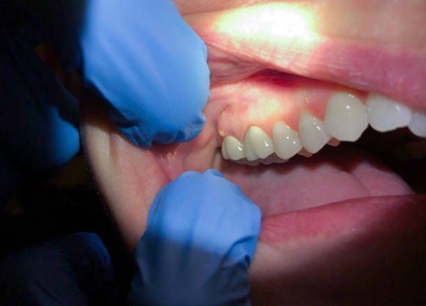 Best 24-Hour Emergency Dentist in East Rockingham, NC