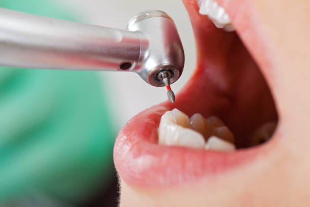  East Rockingham, NC Emergency Dentist Pros